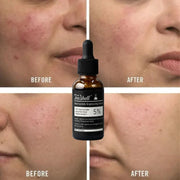 Teashell 5% Niacinamide Brightening Serum