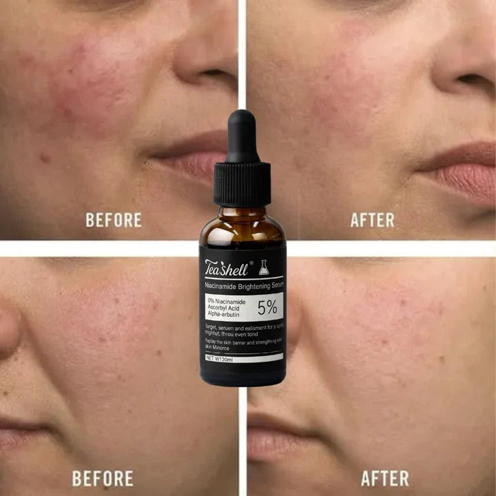Teashell 5% Niacinamide Brightening Serum